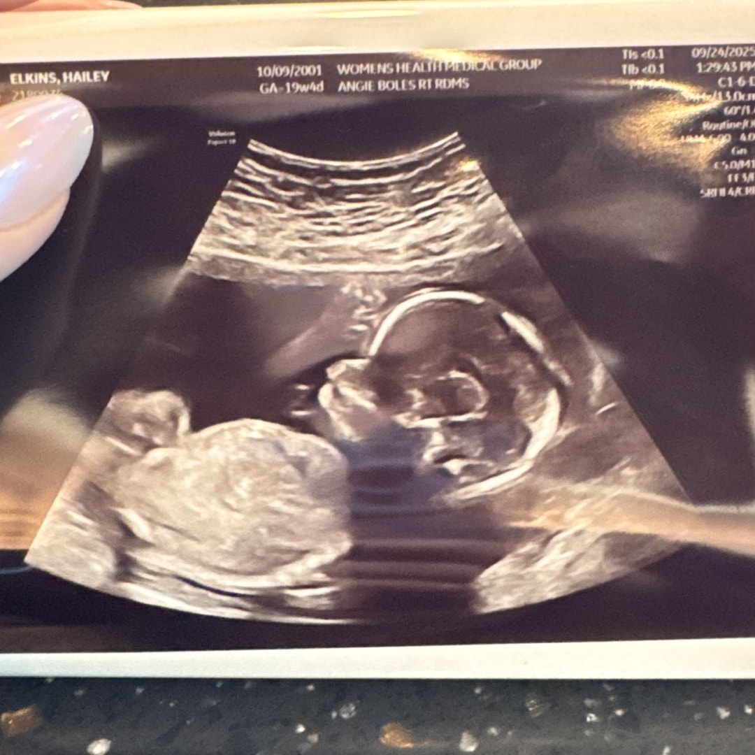 Photo shared by Hailey for their Babylist baby registry.