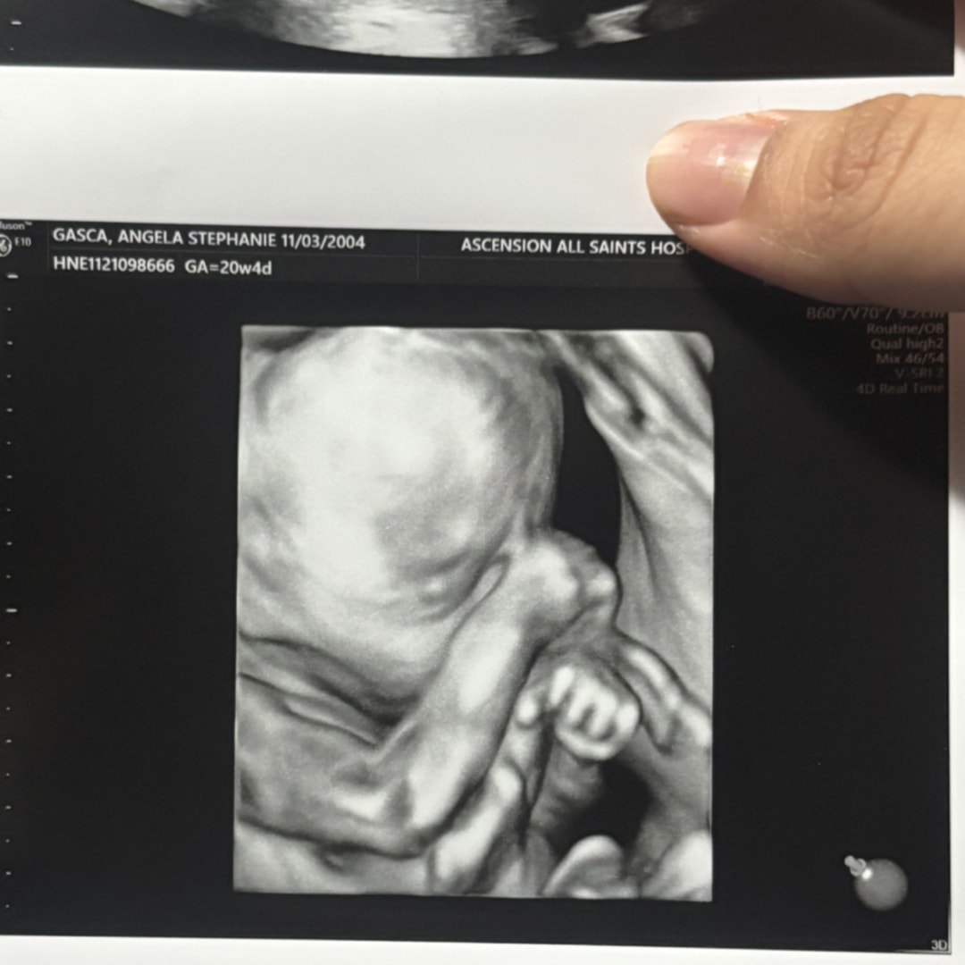 Photo shared by Angela for their Babylist baby registry.