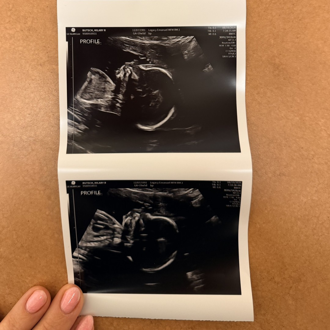 Photo shared by Hilary for their Babylist baby registry.