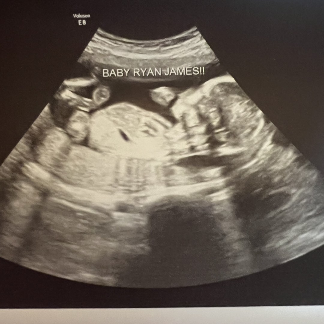 Photo shared by Audrey for their Babylist baby registry.
