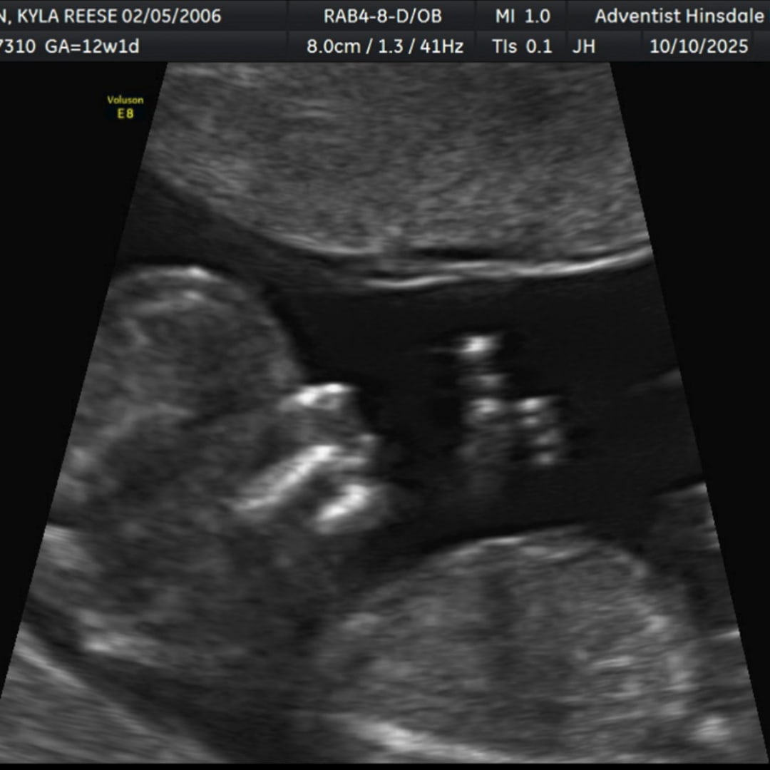 Photo shared by Kyla for their Babylist baby registry.