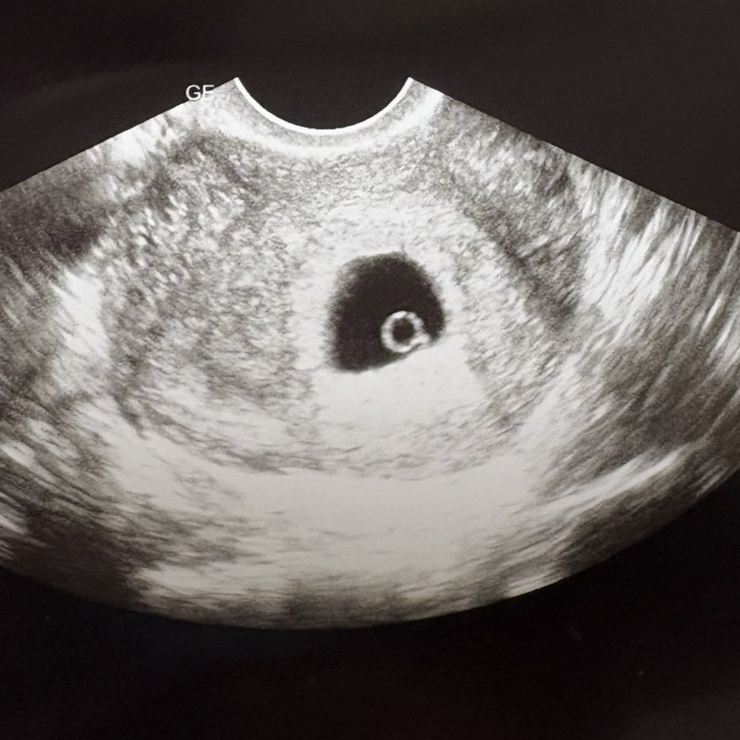 Photo shared by Desiree for their Babylist baby registry.