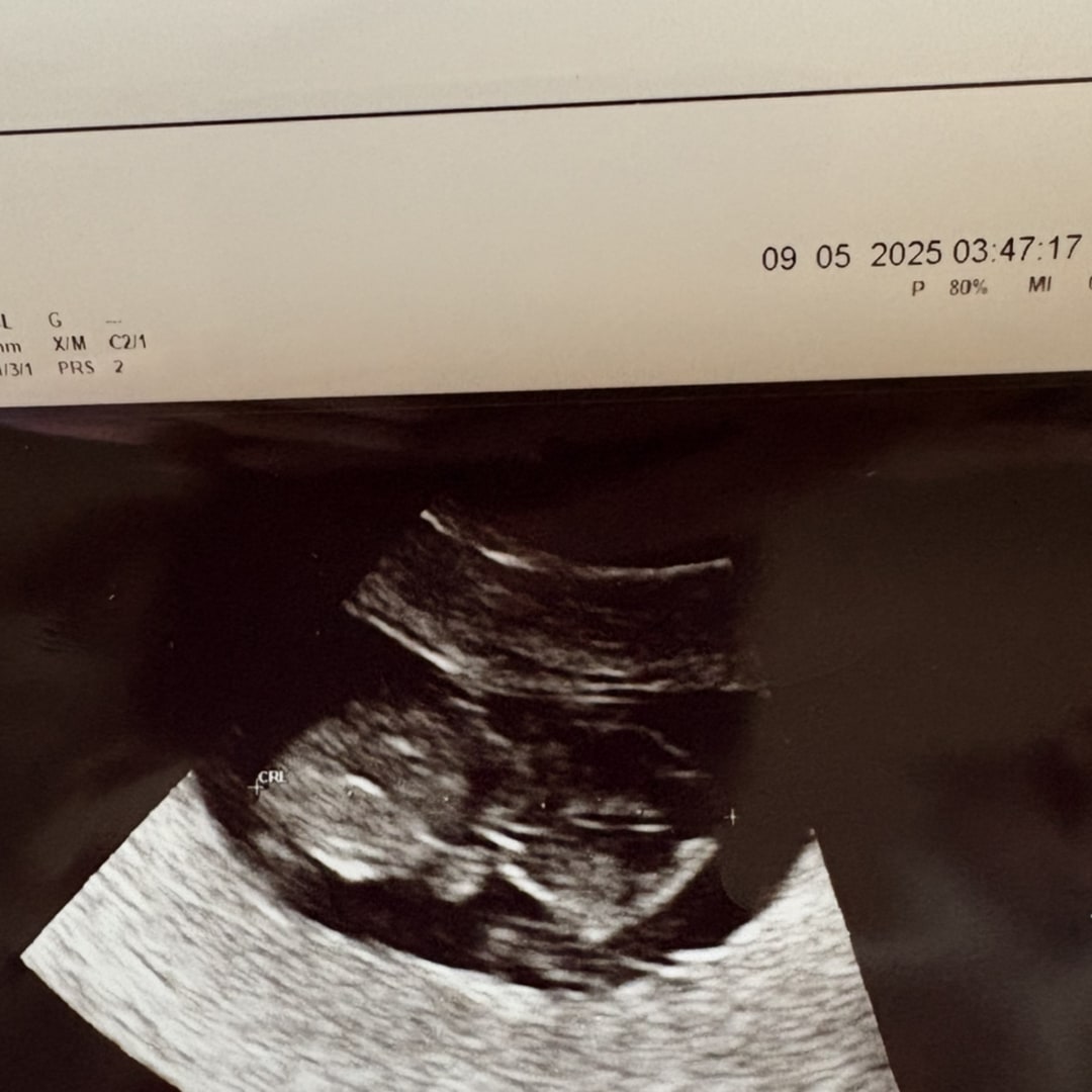 Photo shared by Jade for their Babylist baby registry.