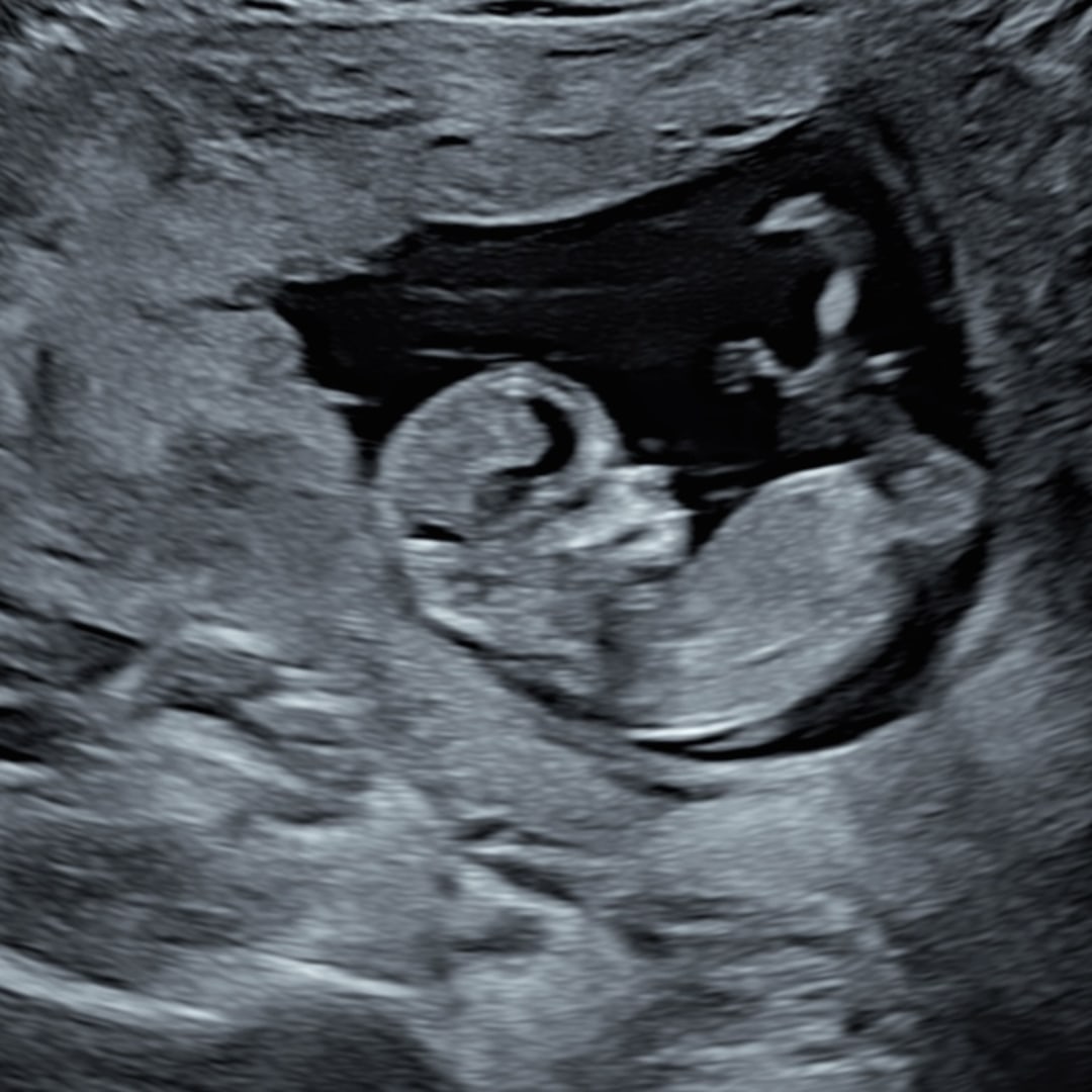 Photo shared by Shelbie for their Babylist baby registry.