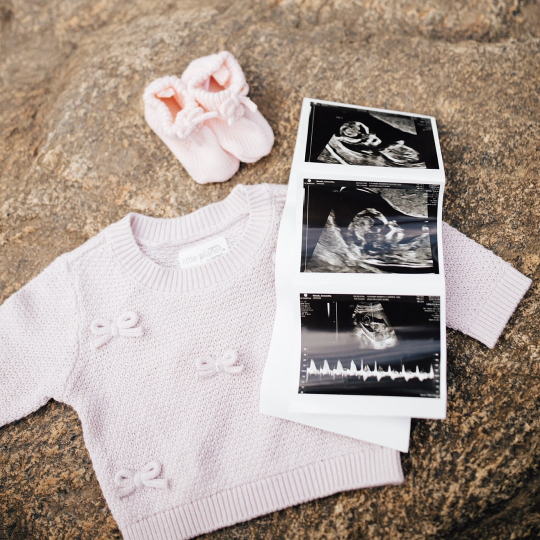 Photo shared by Samantha for their Babylist baby registry.