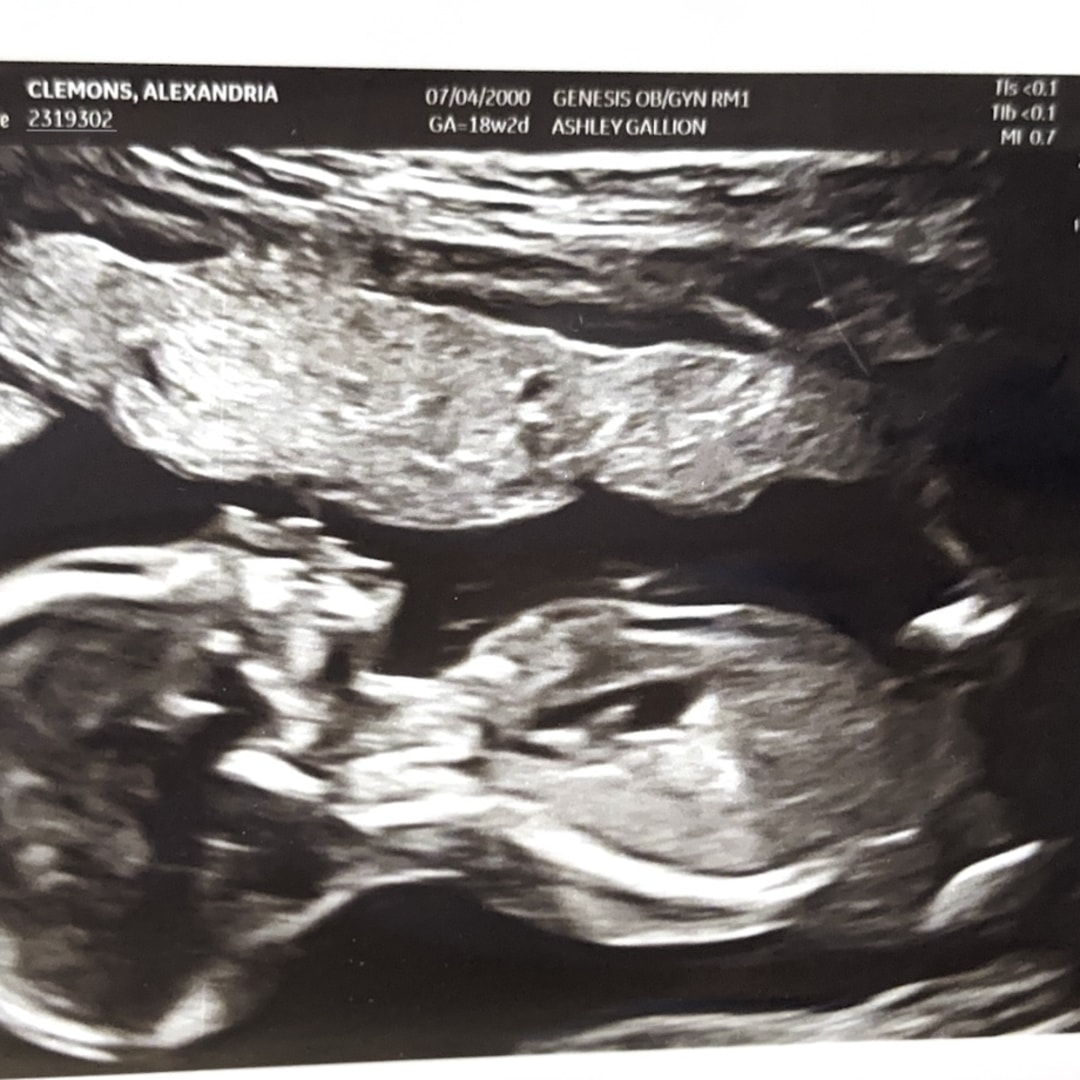 Photo shared by Alex for their Babylist baby registry.