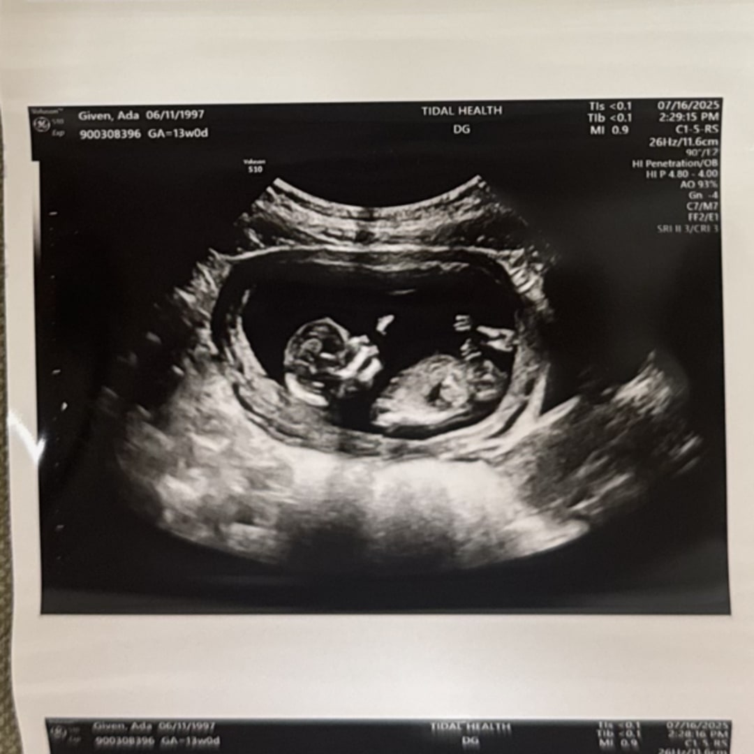 Photo shared by Ada for their Babylist baby registry.