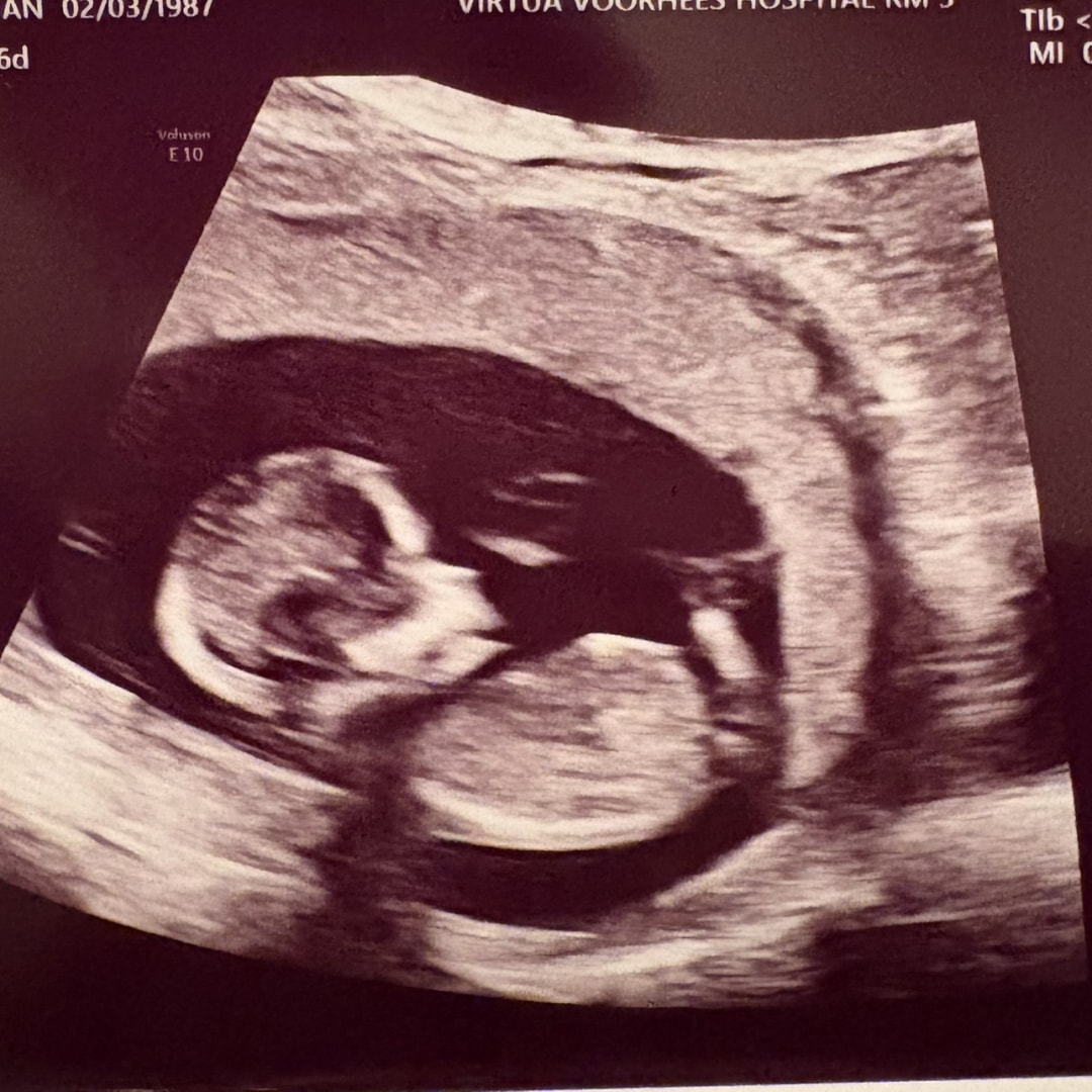 Photo shared by Meghan for their Babylist baby registry.