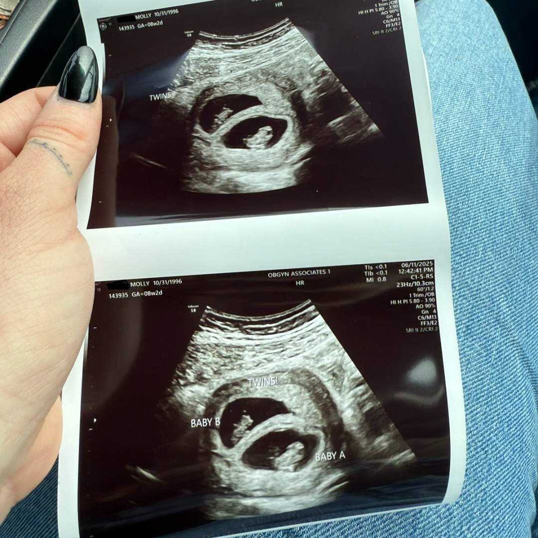 Photo shared by Molly for their Babylist baby registry.