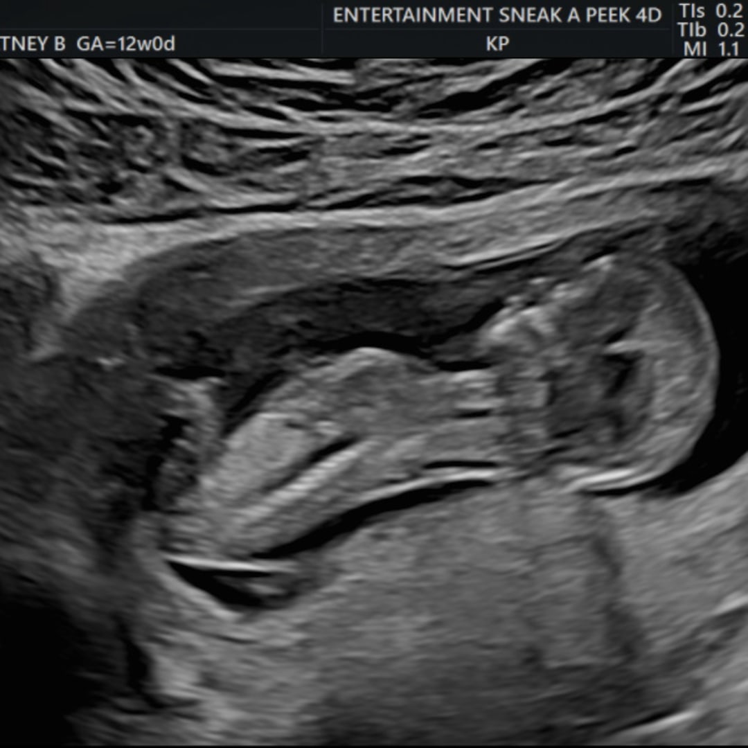 Photo shared by Courtney for their Babylist baby registry.