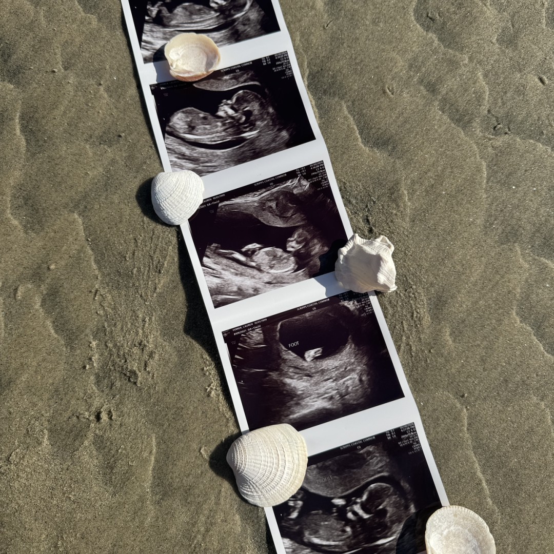 Photo shared by Lauren for their Babylist baby registry.