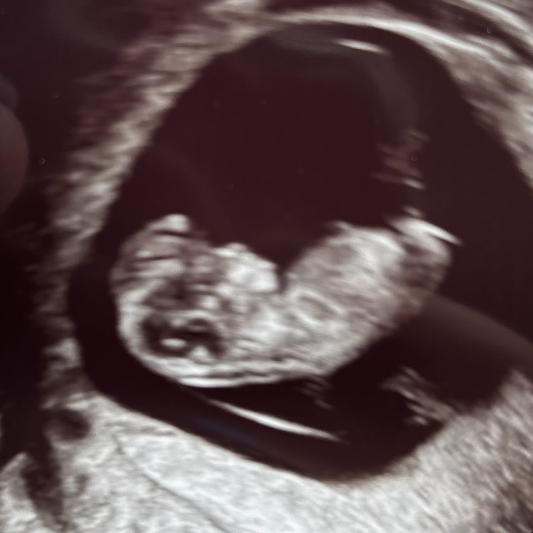 Photo shared by Cathy for their Babylist baby registry.