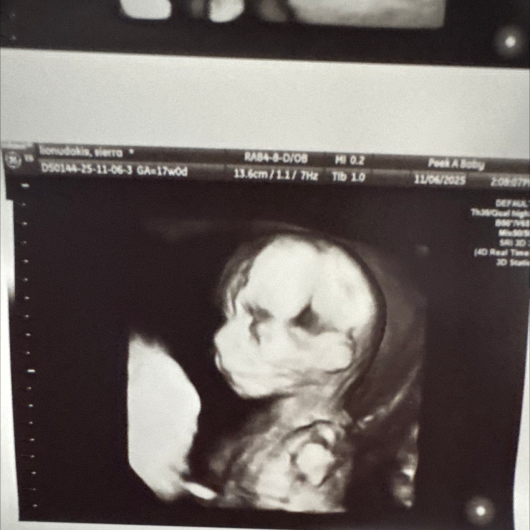 Photo shared by Sierra for their Babylist baby registry.