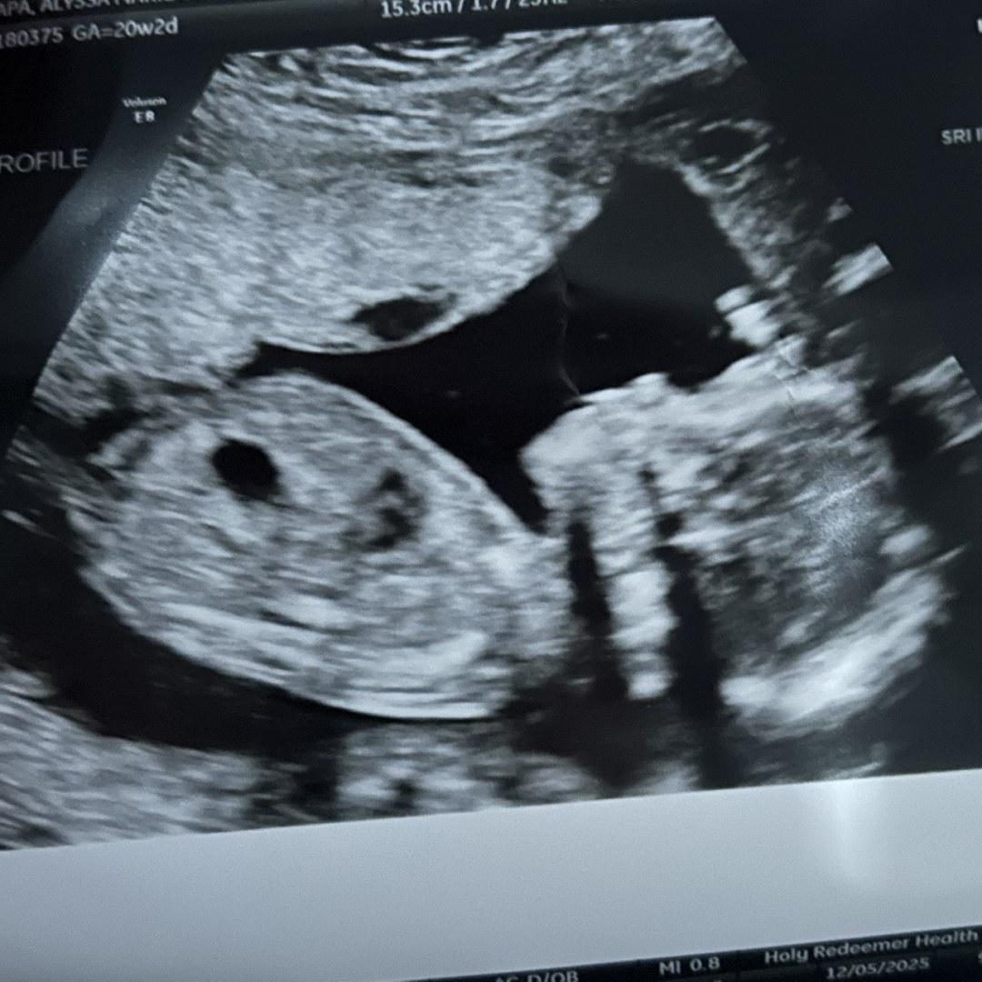 Photo shared by Alyssa for their Babylist baby registry.