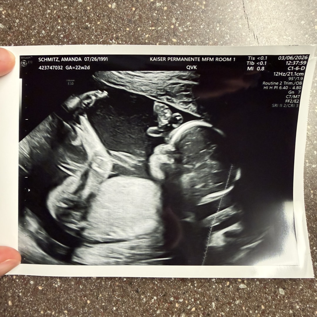 Photo shared by Amanda for their Babylist baby registry.