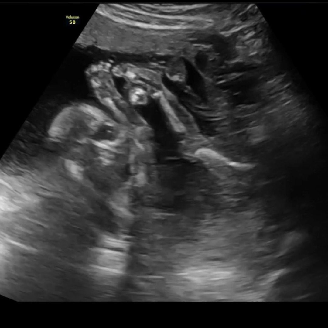 Photo shared by Dixie for their Babylist baby registry.