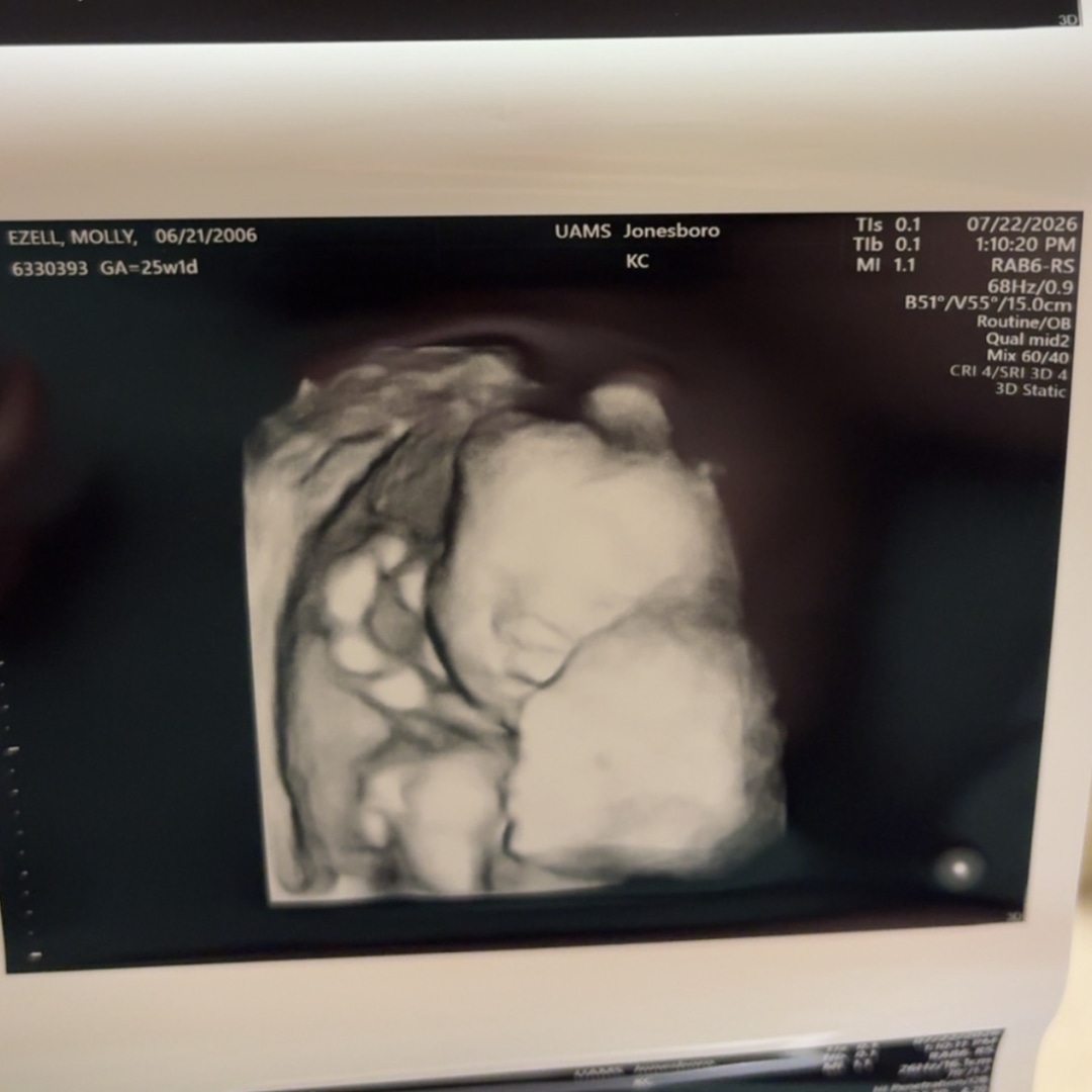 Photo shared by Molly for their Babylist baby registry.