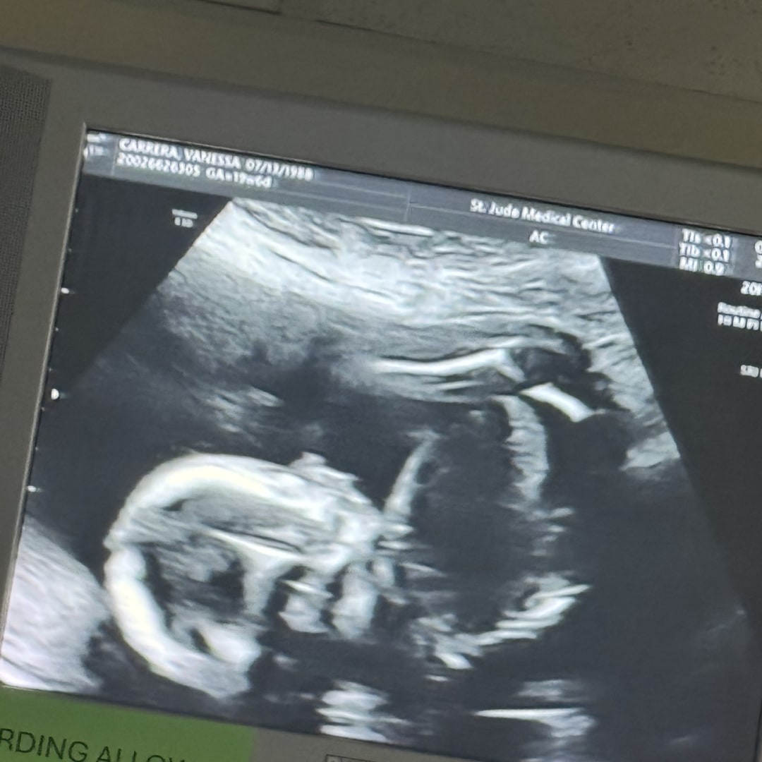 Photo shared by Vanessa for their Babylist baby registry.