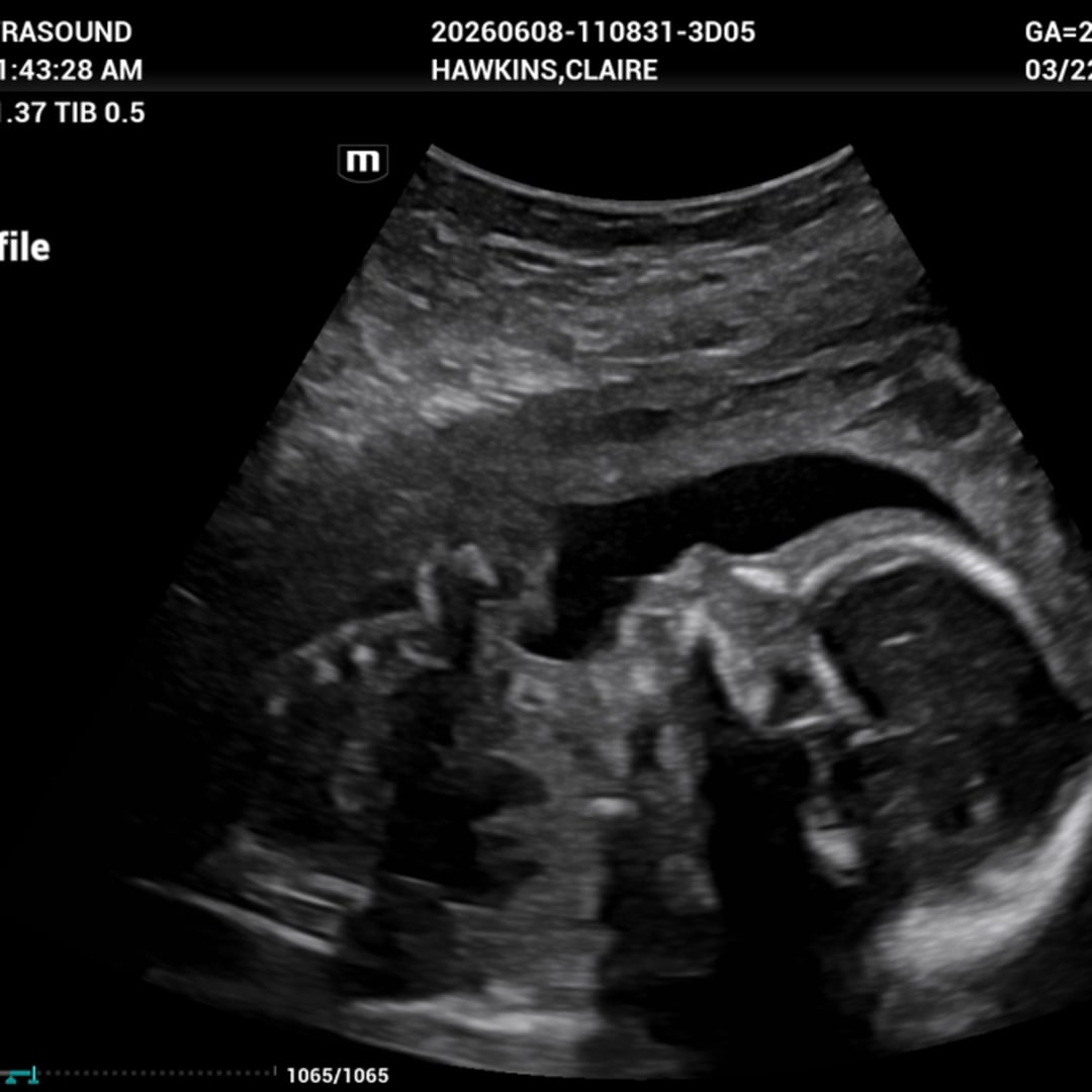 Photo shared by Claire for their Babylist baby registry.