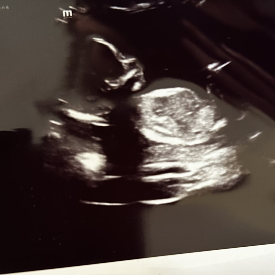 Photo shared by Rachel for their Babylist baby registry.