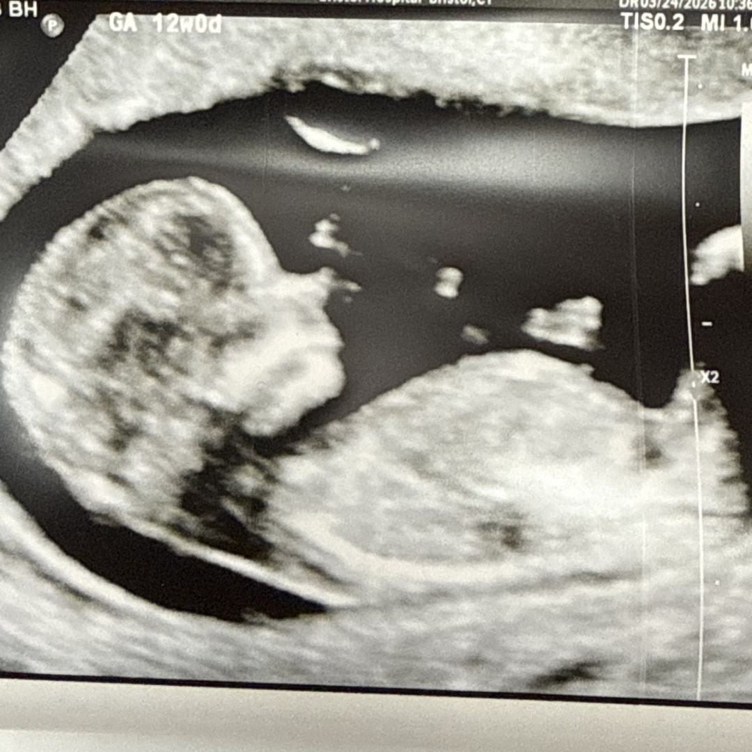 Photo shared by Ryan for their Babylist baby registry.
