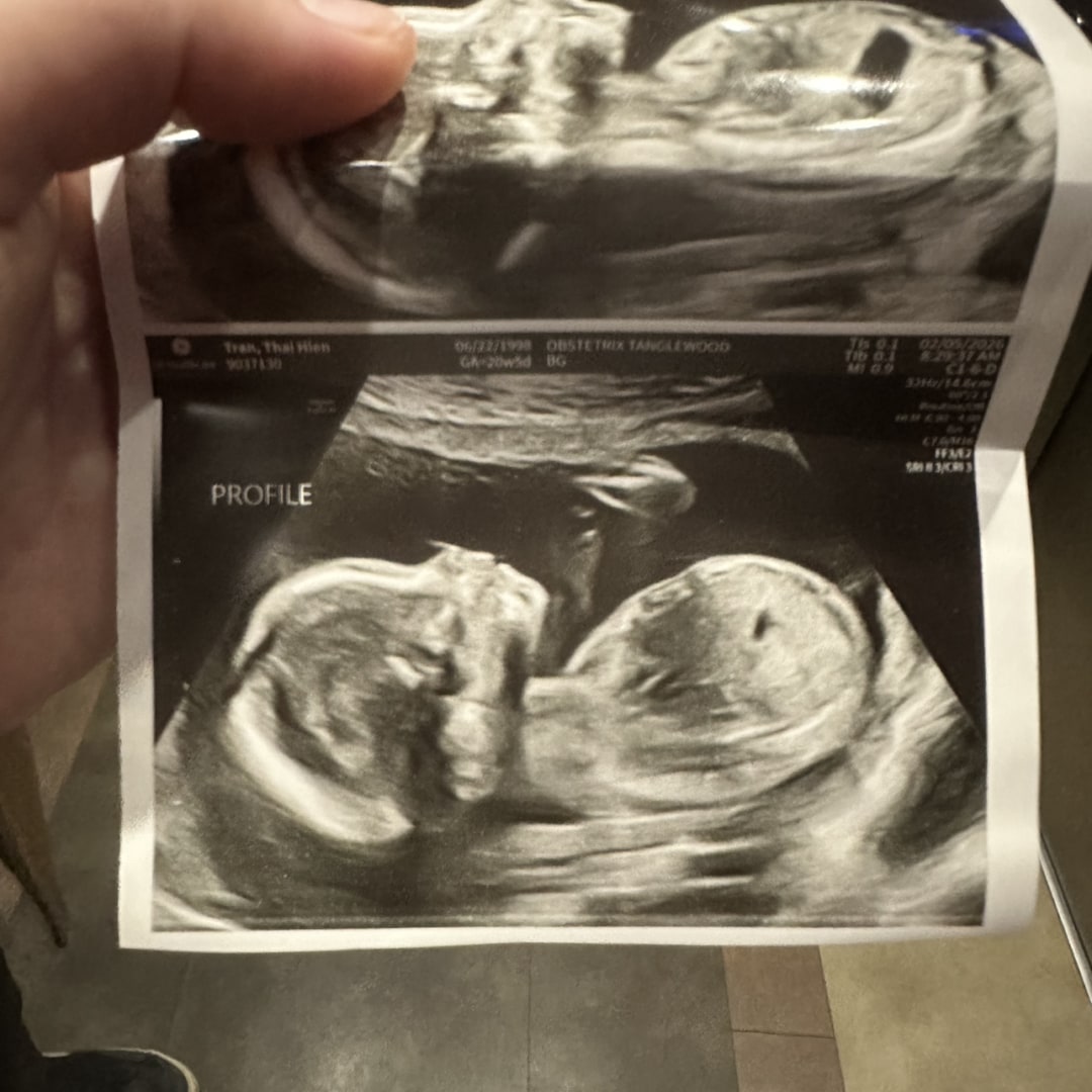 Photo shared by Hien for their Babylist baby registry.