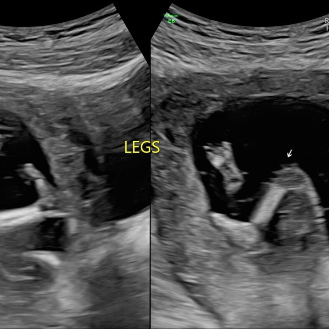 Photo shared by Leslie for their Babylist baby registry.
