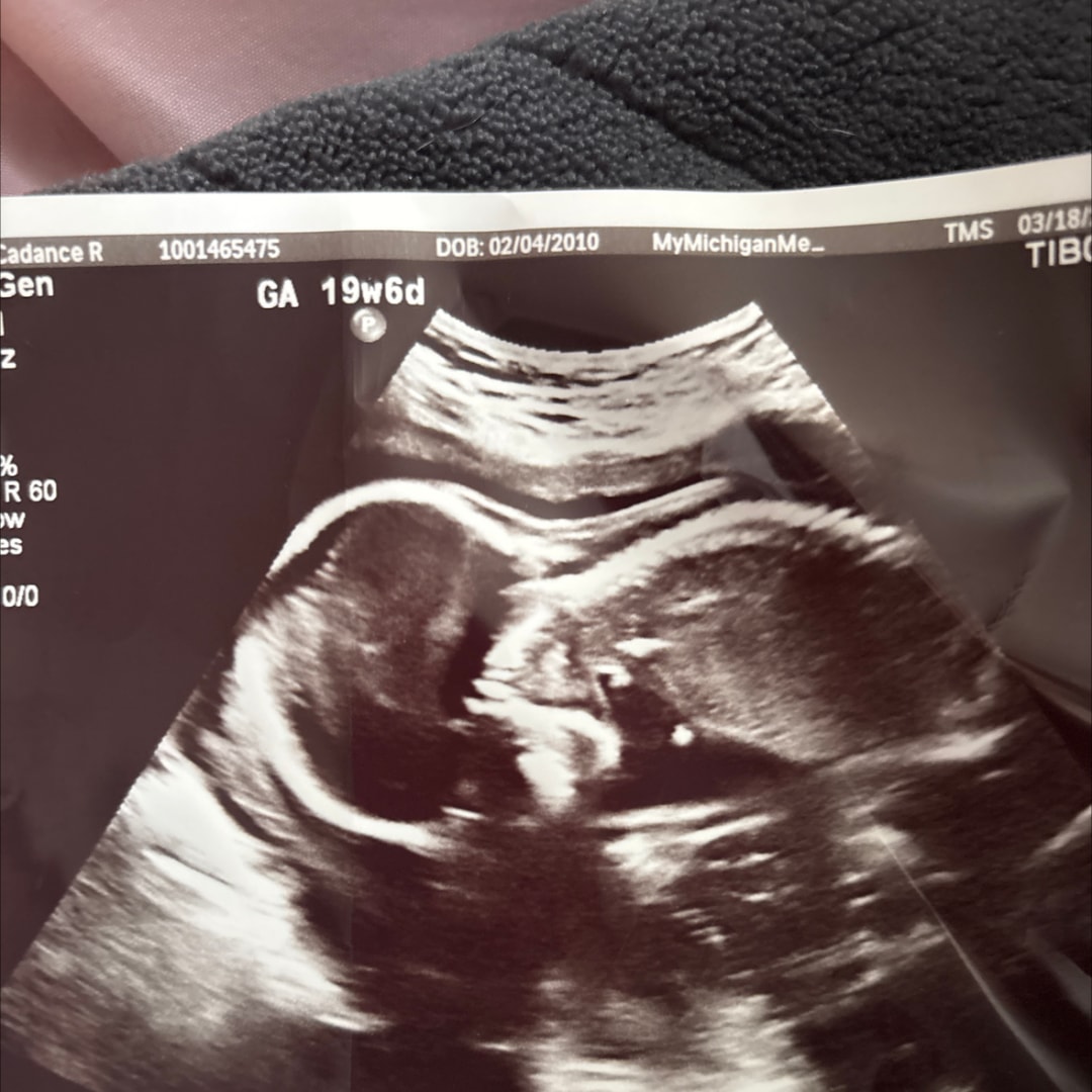 Photo shared by Cady for their Babylist baby registry.