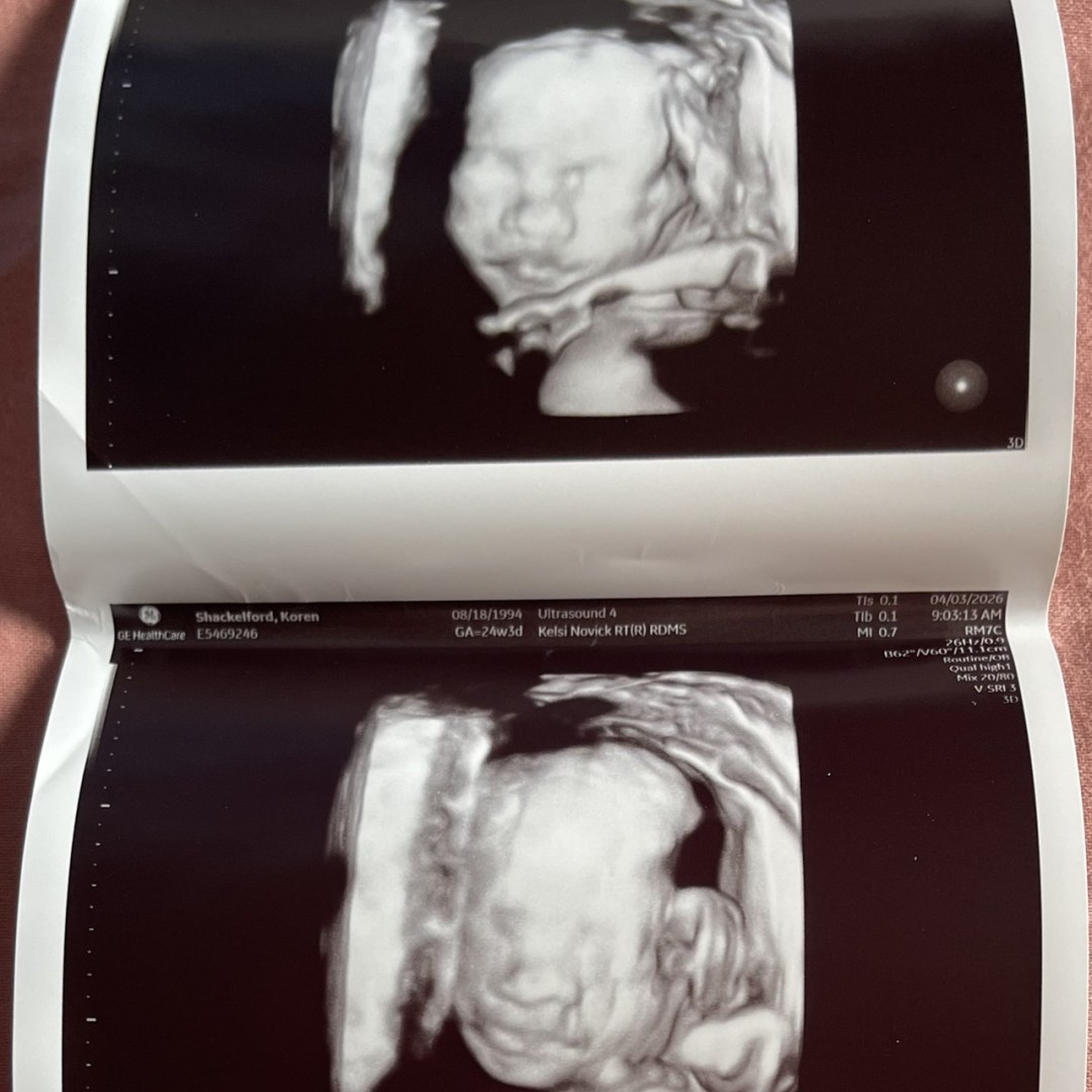 Photo shared by Kory for their Babylist baby registry.