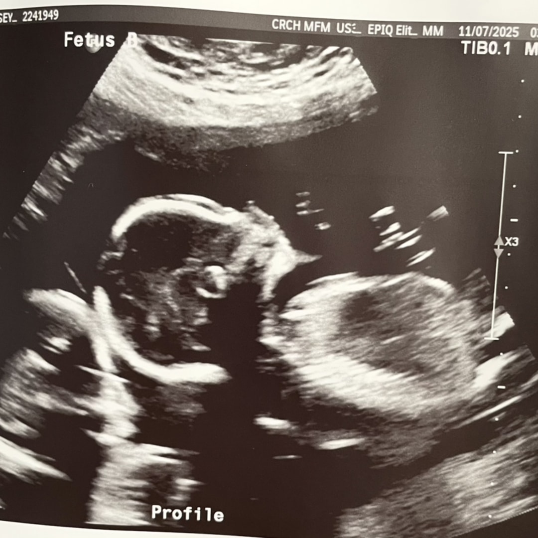 Photo shared by Chelsey for their Babylist baby registry.