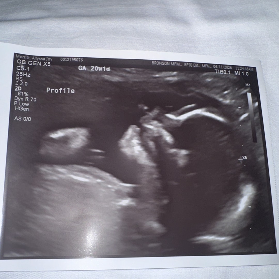 Photo shared by Allyssa for their Babylist baby registry.