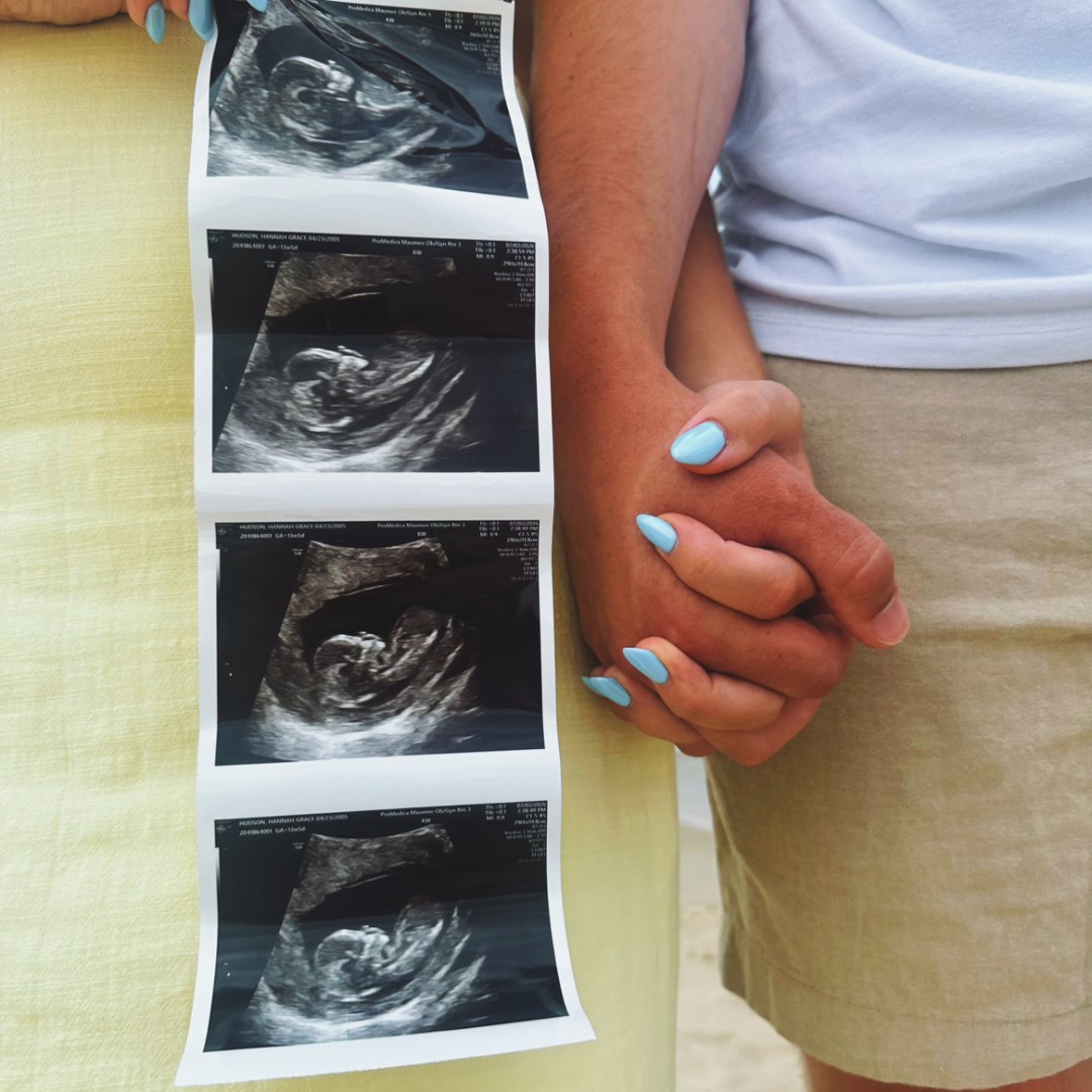Photo shared by Hannah for their Babylist baby registry.