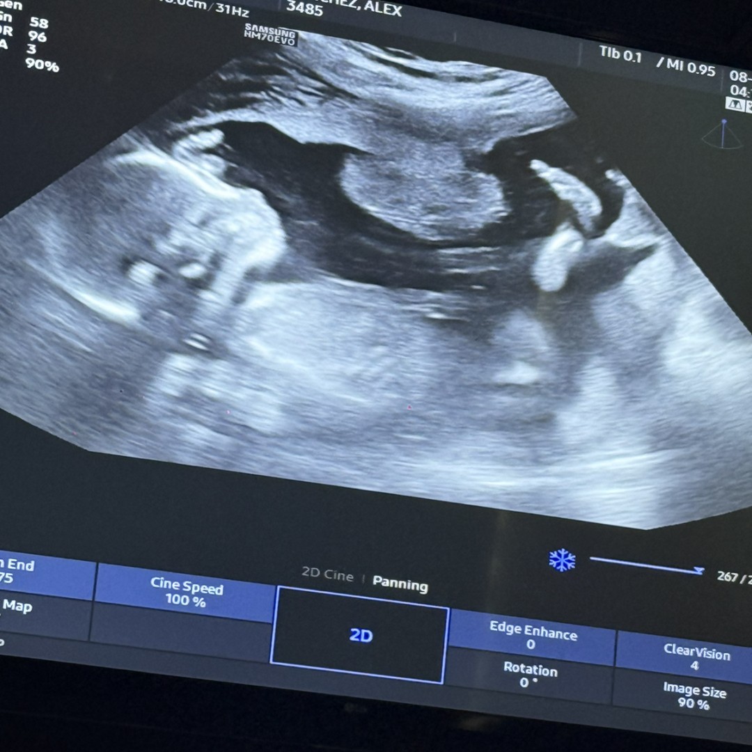 Photo shared by Alex for their Babylist baby registry.