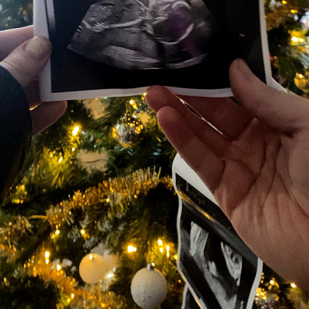 Photo shared by McKenzie for their Babylist baby registry.