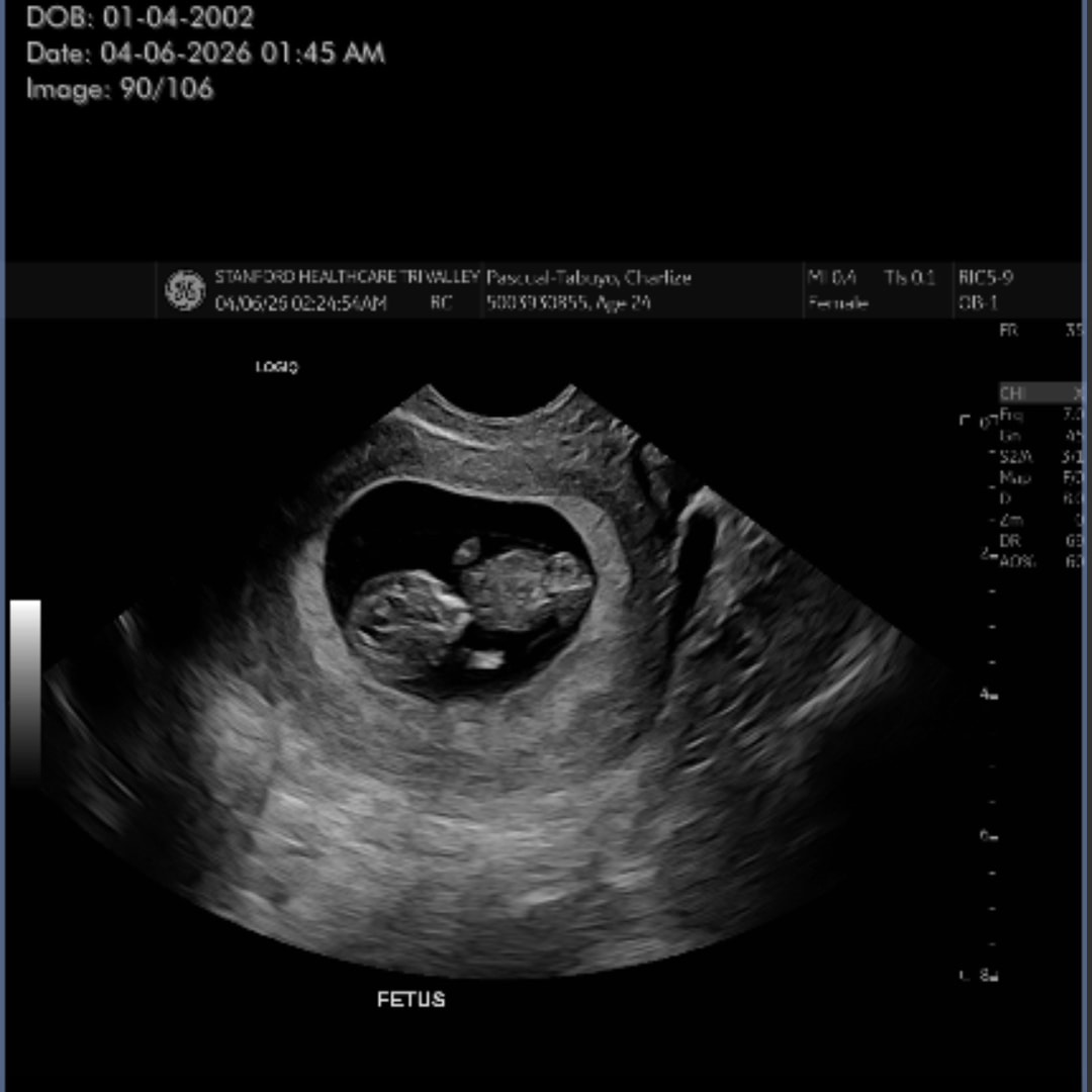 Photo shared by Charlize Jasmine for their Babylist baby registry.