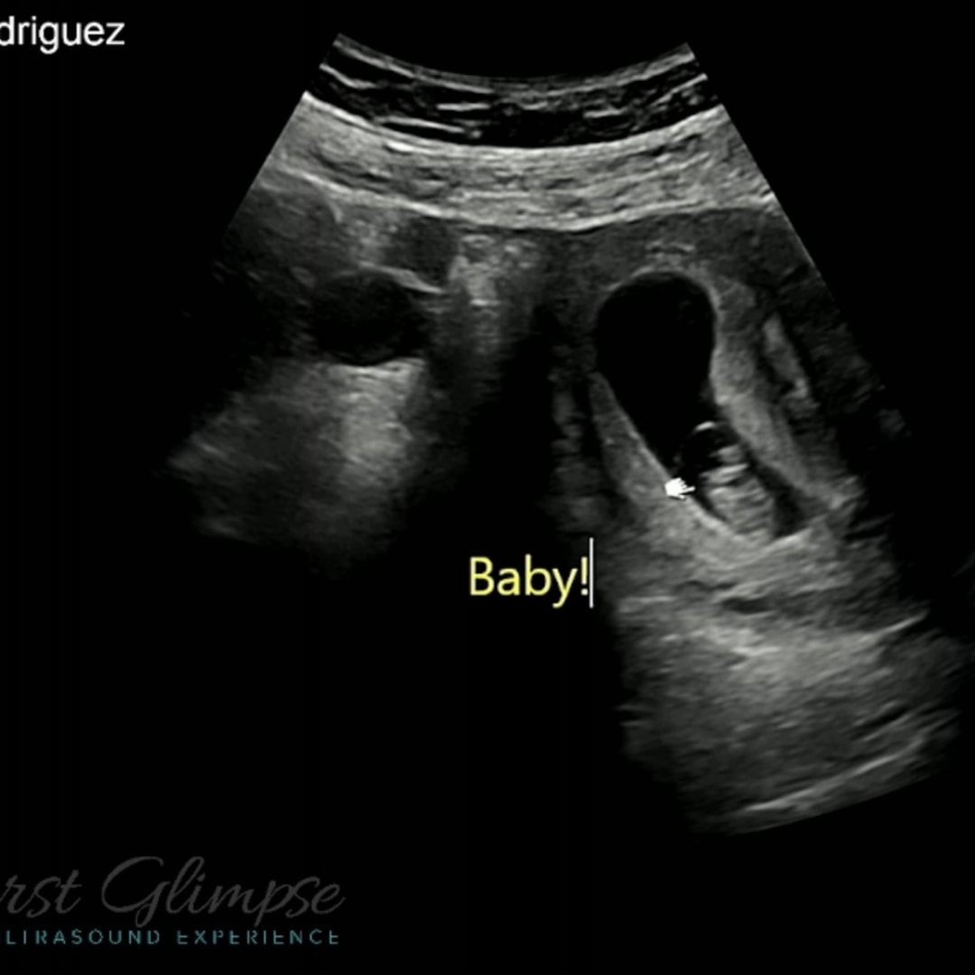 Photo shared by Jessica for their Babylist baby registry.