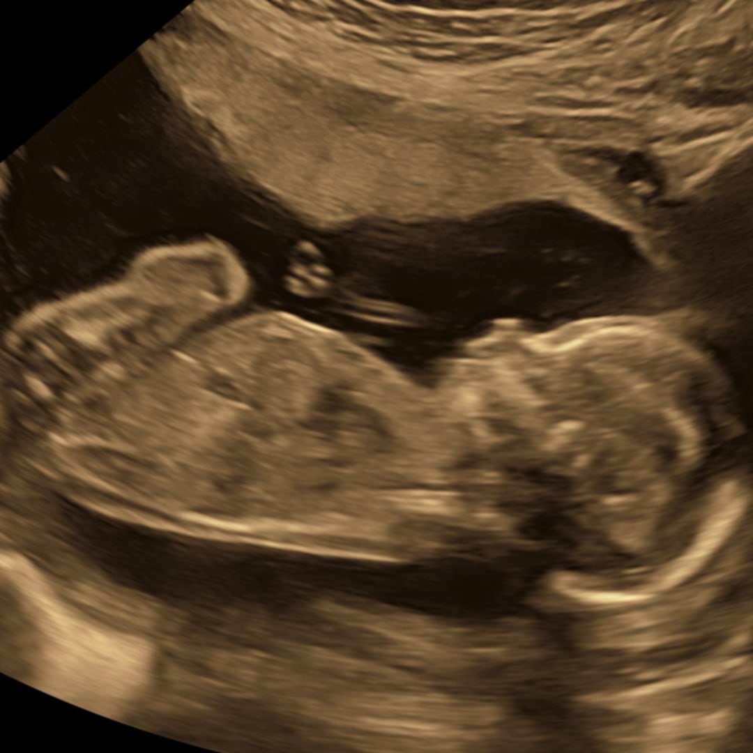 Photo shared by Evelyn for their Babylist baby registry.