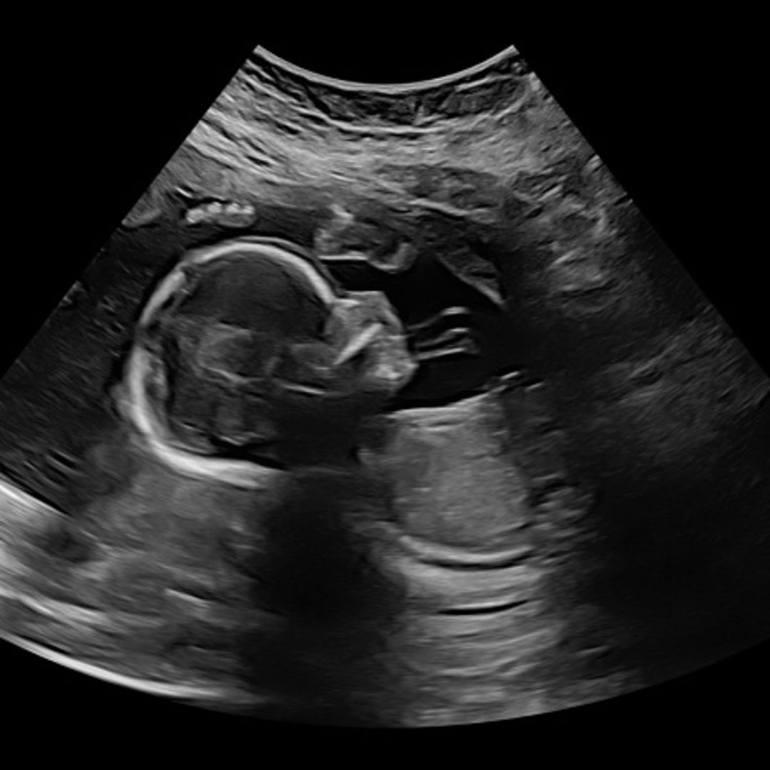 Photo shared by Haley for their Babylist baby registry.
