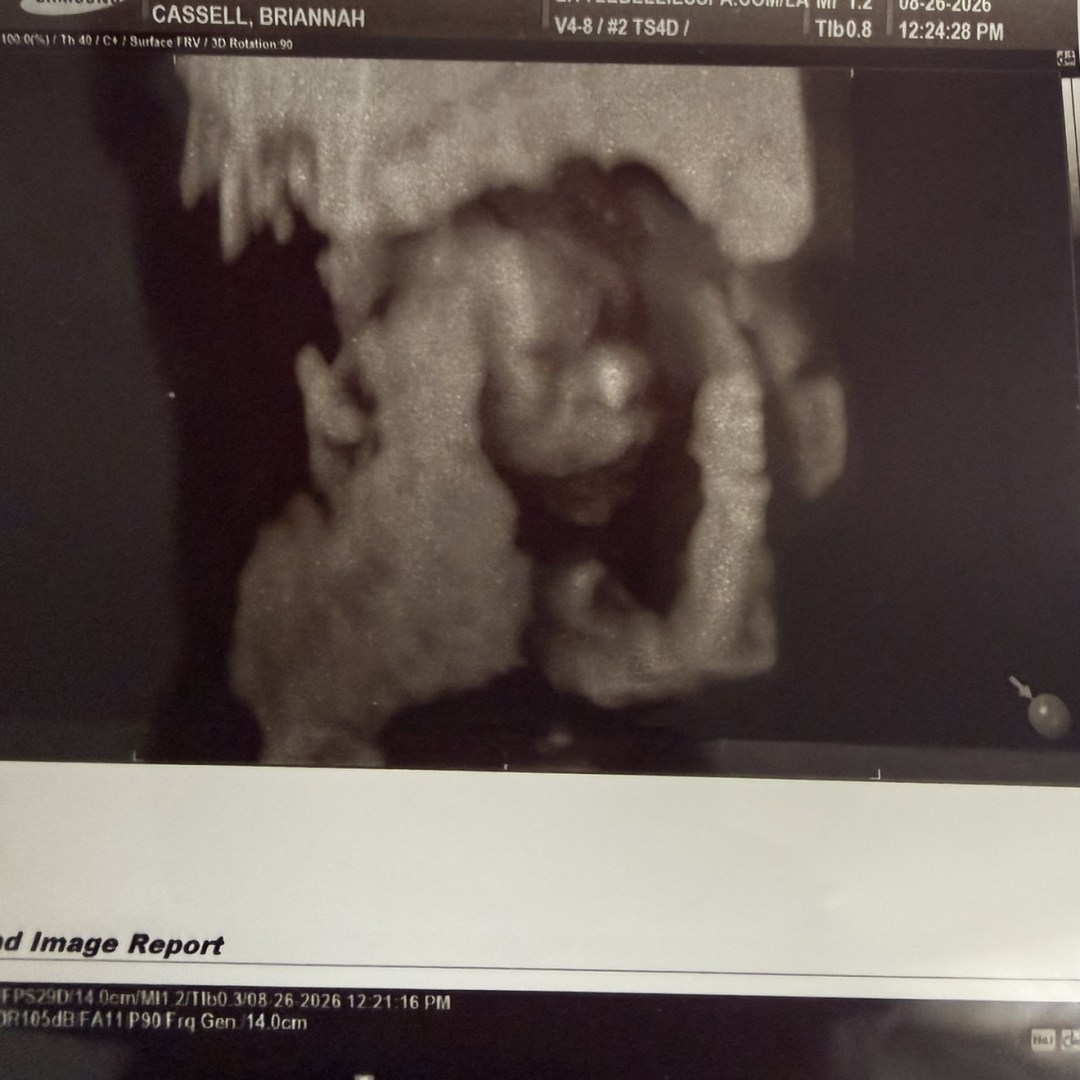 Photo shared by Briannah for their Babylist baby registry.