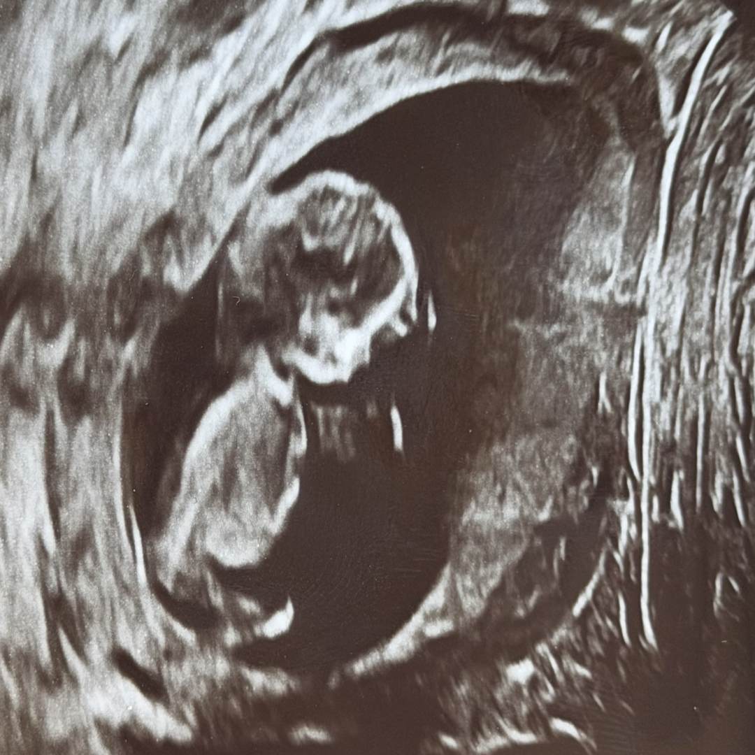 Photo shared by Brandi for their Babylist baby registry.