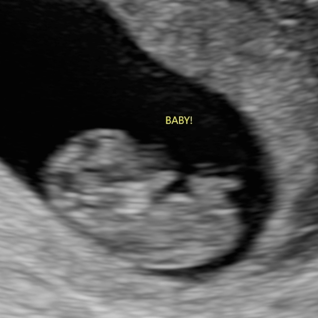 Photo shared by Sakiya for their Babylist baby registry.