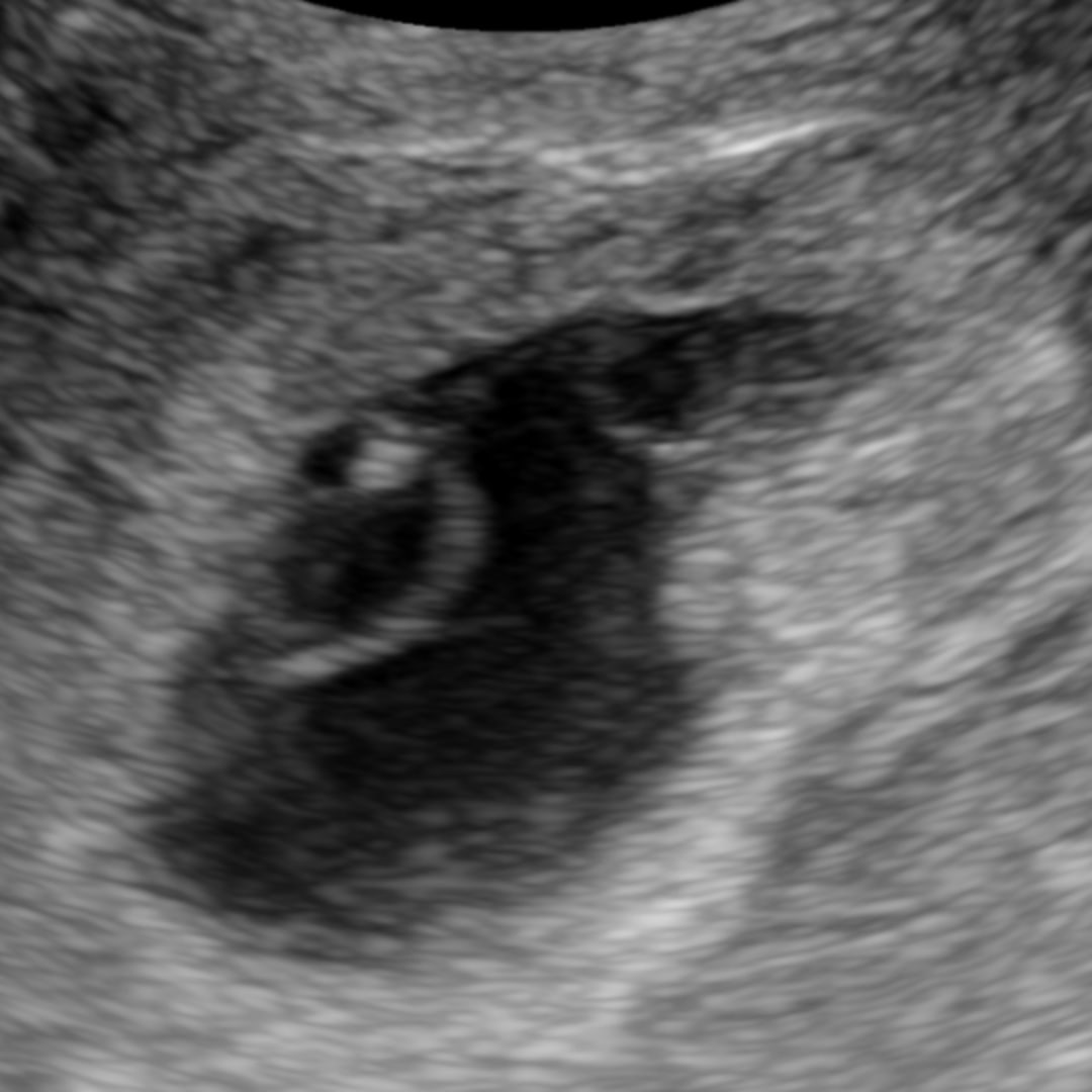 Photo shared by Amanda for their Babylist baby registry.