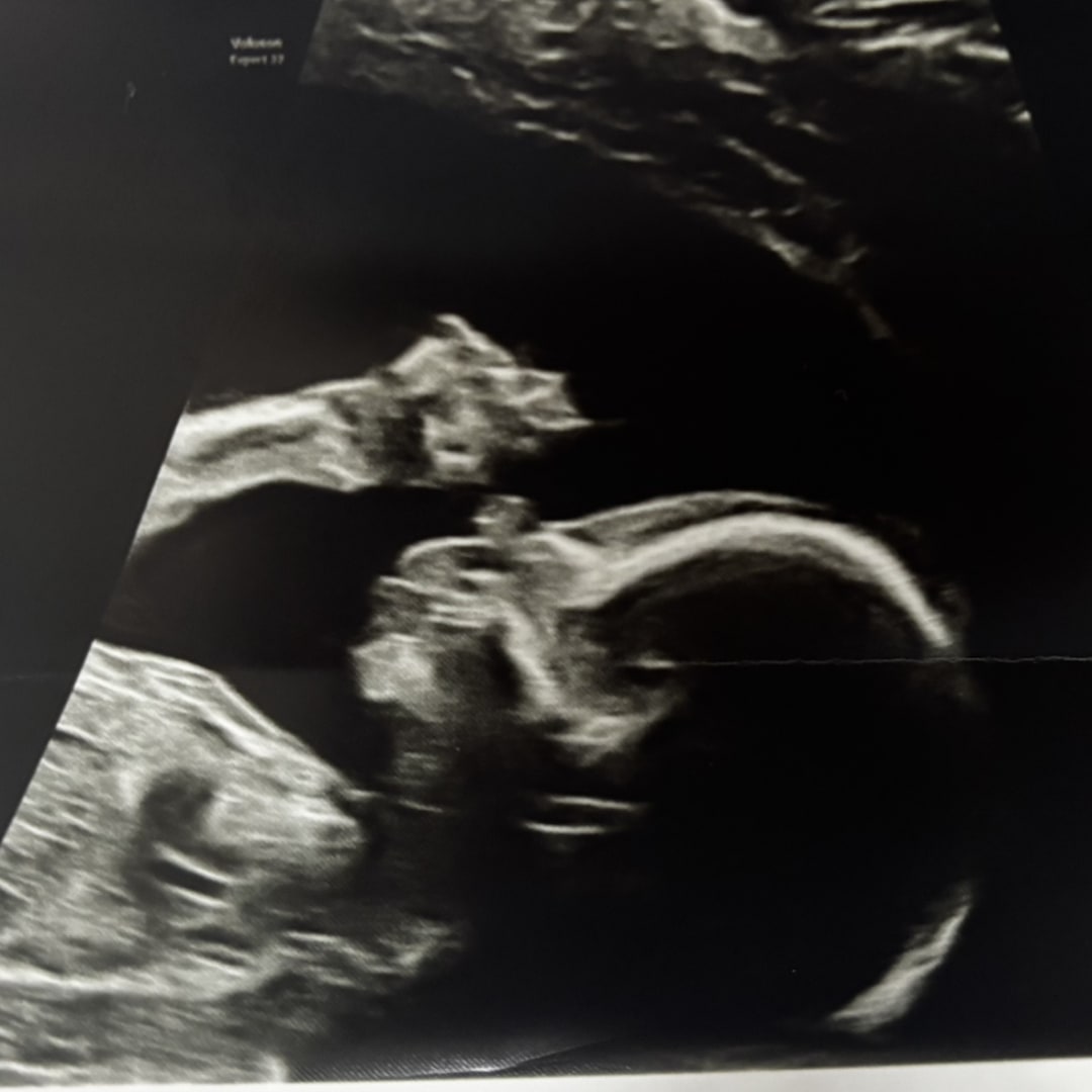 Photo shared by Brianna for their Babylist baby registry.