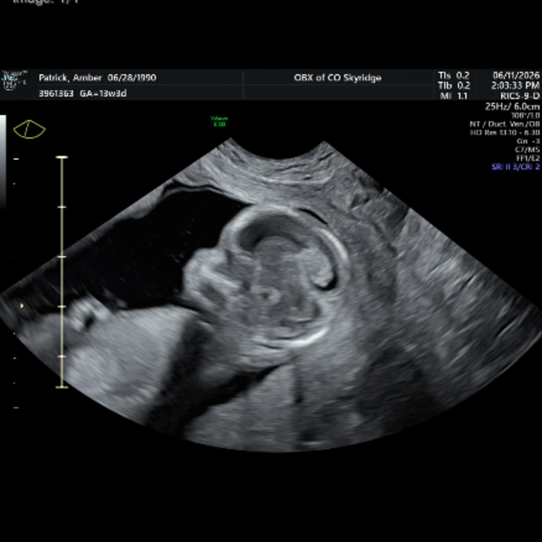 Photo shared by Amber for their Babylist baby registry.