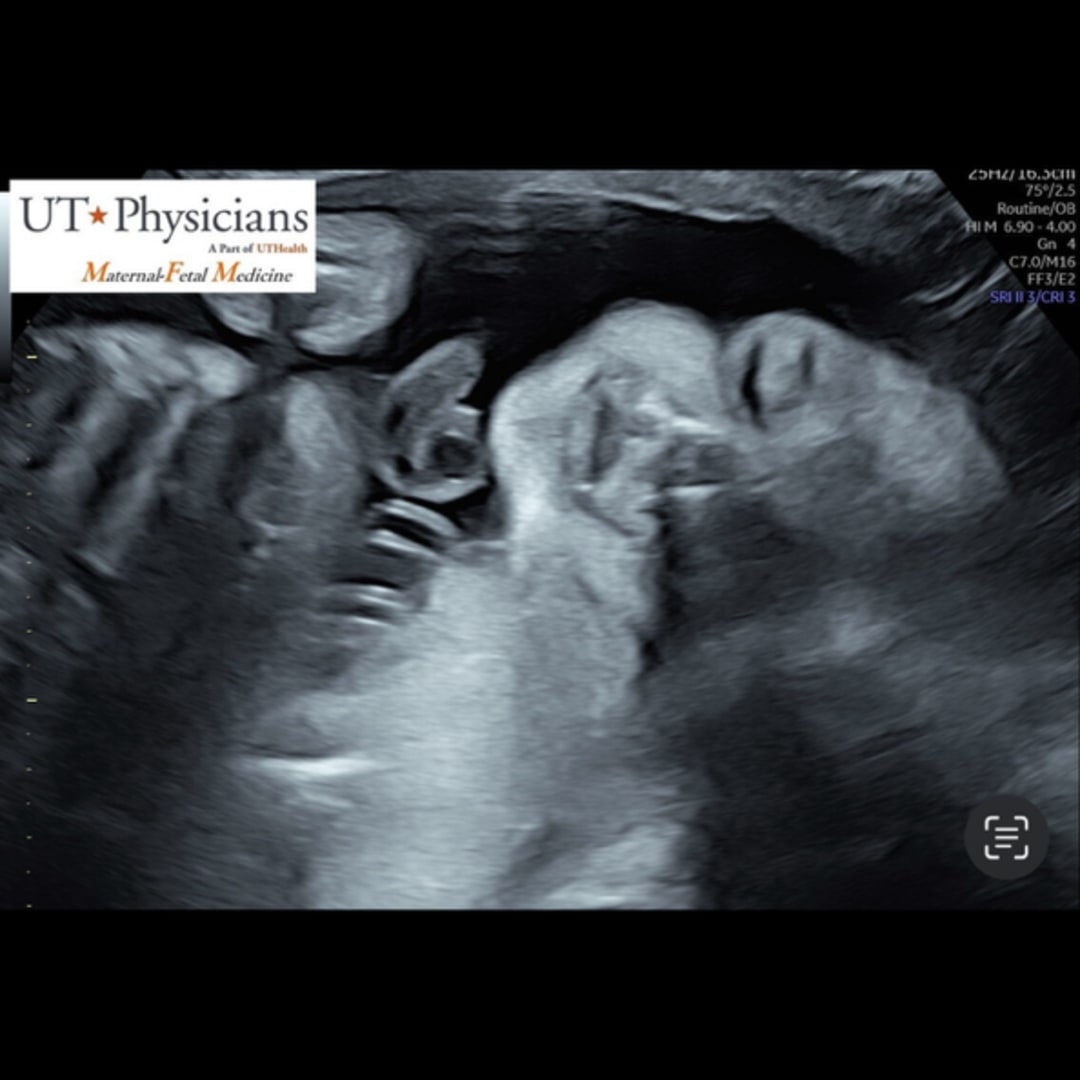 Photo shared by Larissa for their Babylist baby registry.