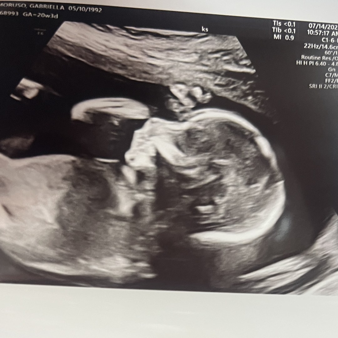 Photo shared by Gabriella for their Babylist baby registry.