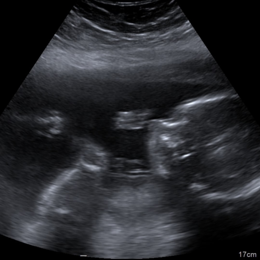 Photo shared by Gracie for their Babylist baby registry.