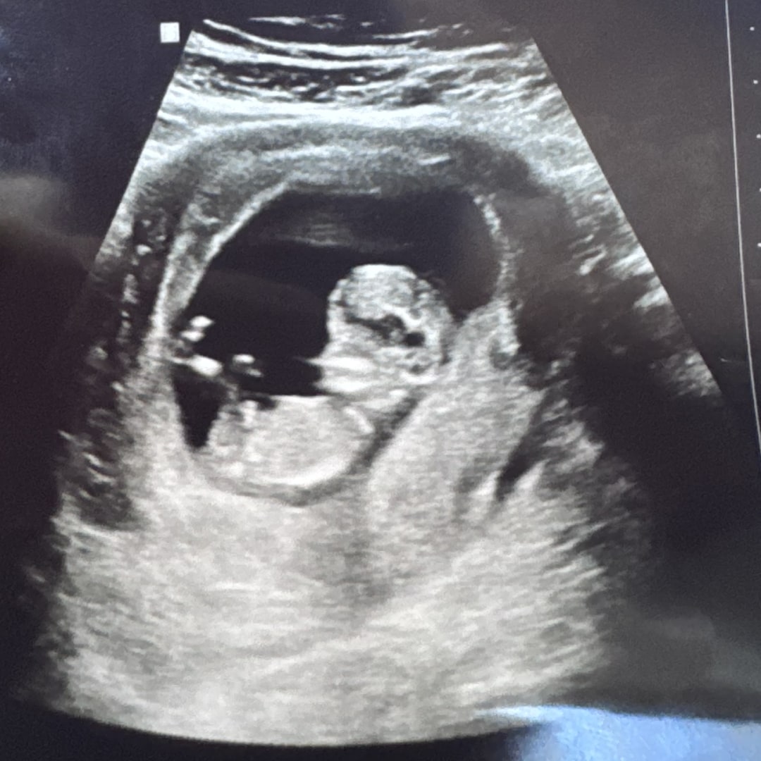 Photo shared by Adieliz for their Babylist baby registry.