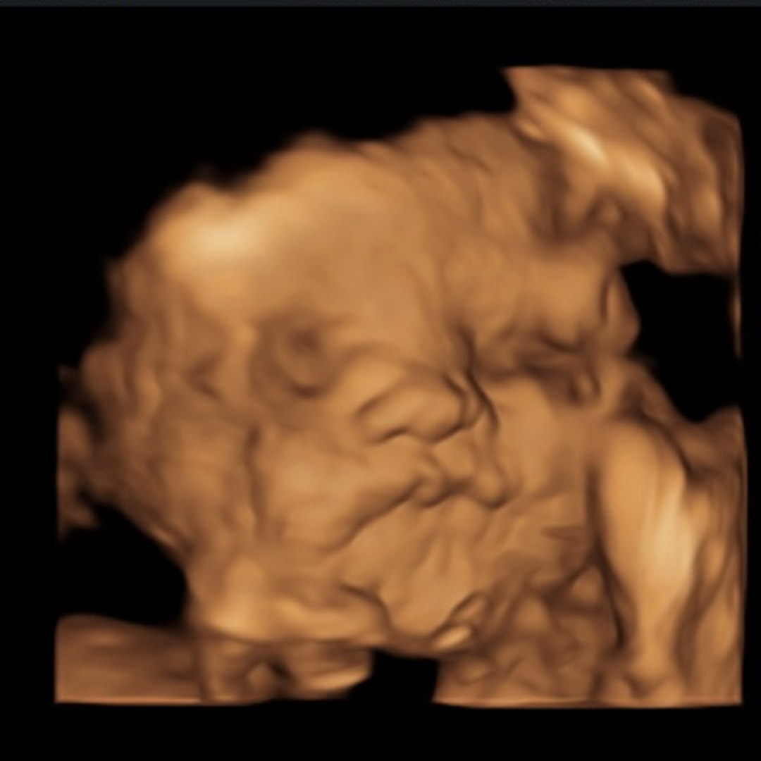 Photo shared by Kathlene for their Babylist baby registry.