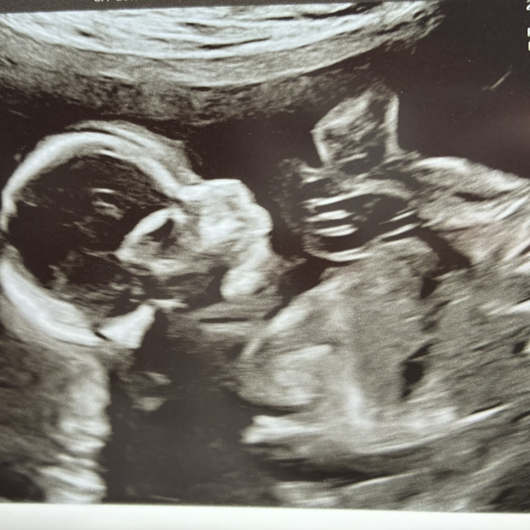 Photo shared by Shealyn for their Babylist baby registry.